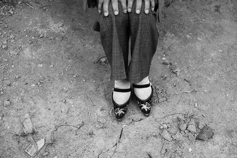 China; Binding foot by Mattia Passarini