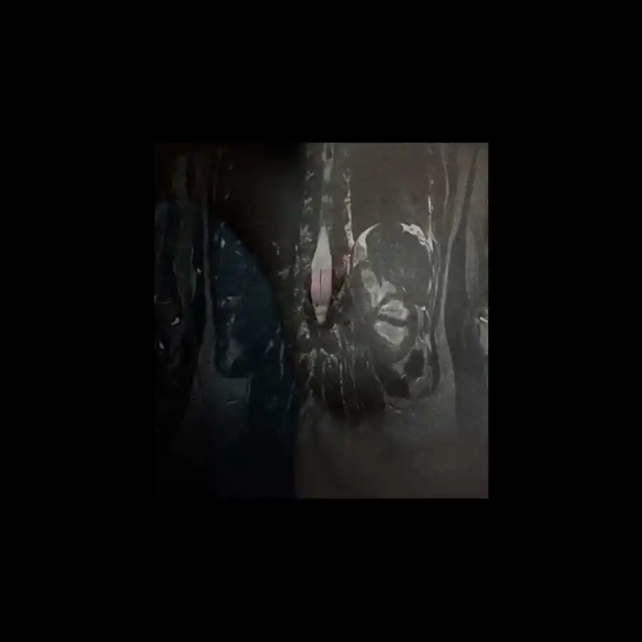 limits of existence_ani zur_18