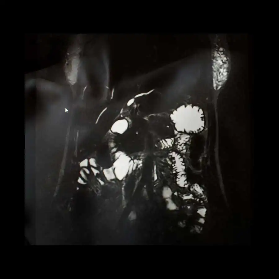 limits of existence_ani zur_3