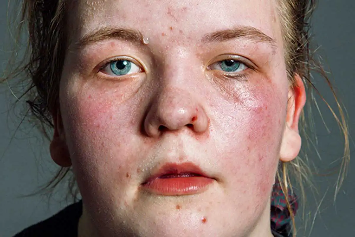 Second Best by Nikolai Linares