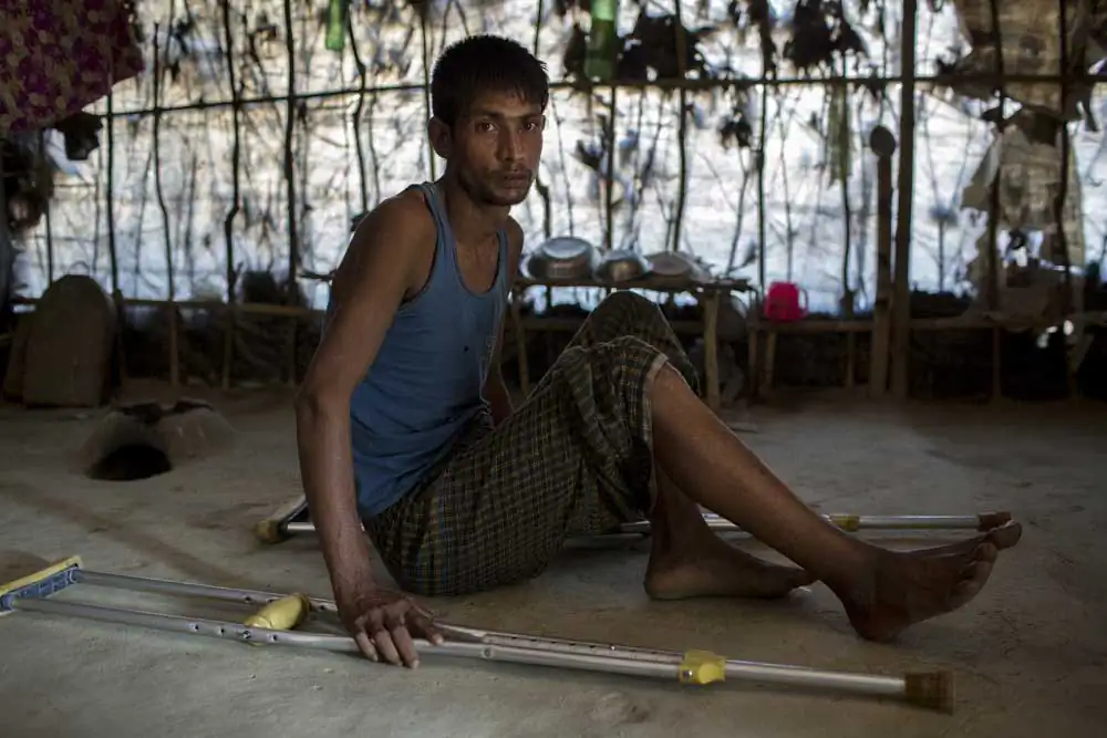 Mohammad Muslim, 30, who fled from recent violence in Myanmar, takes shelter in Balu Kali Rohingya refugee camp, Coxs Bazar. Burmese military shot him in his leg as he was fleeing.