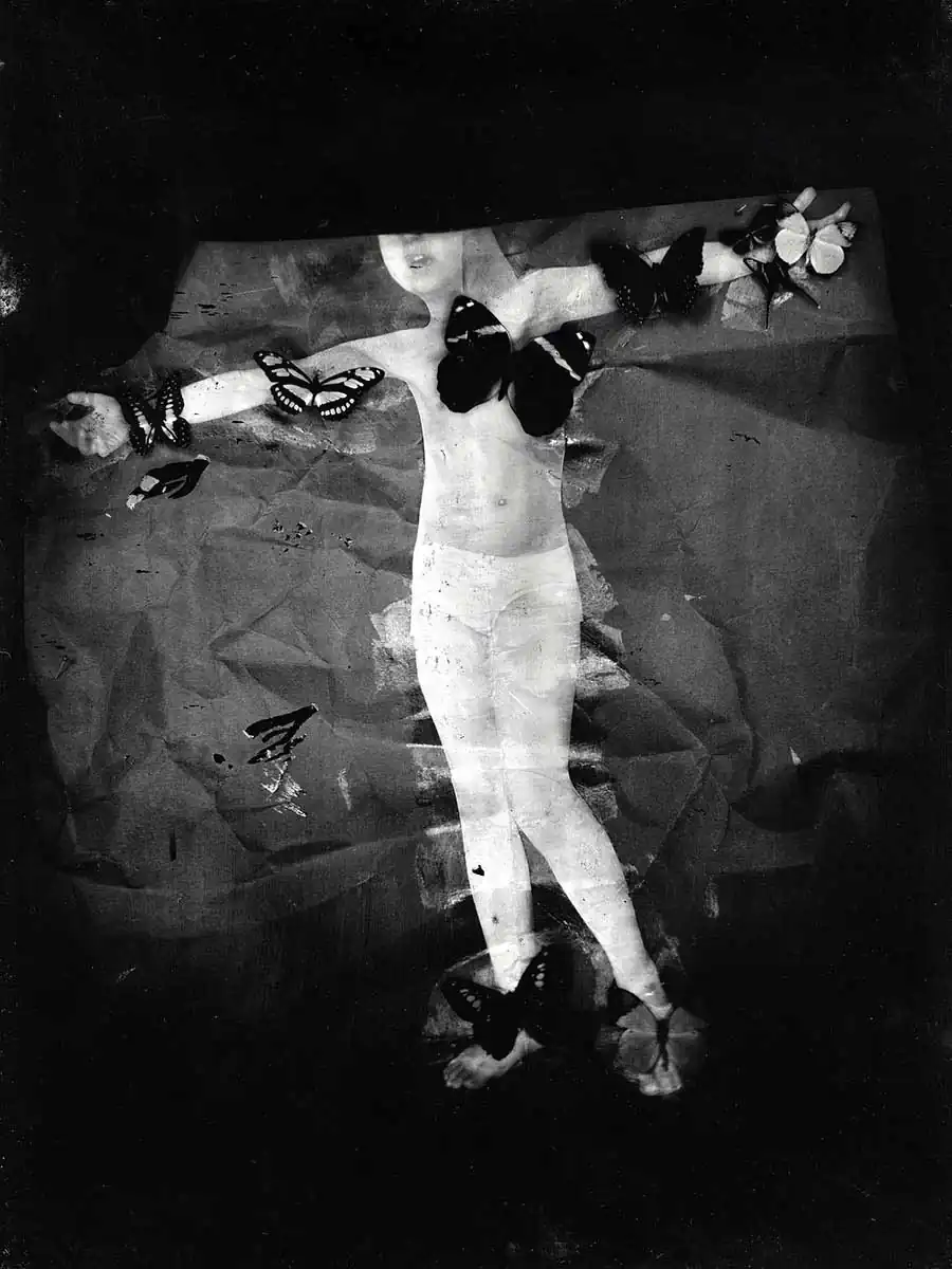 Marzena Kolarz ; ALL / acute lymphoblastic leukemia