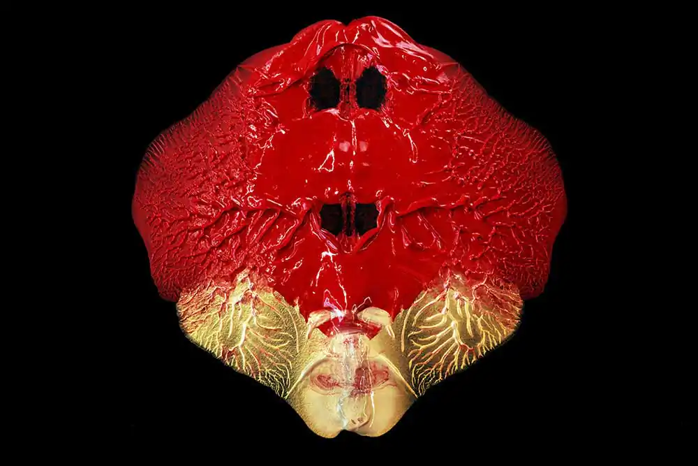 Fine art photography ; Premature by Giovanni De Benedetto