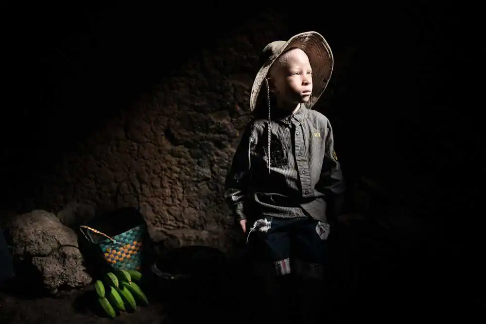 Disabled in Rwanda by Lukasz Sokol