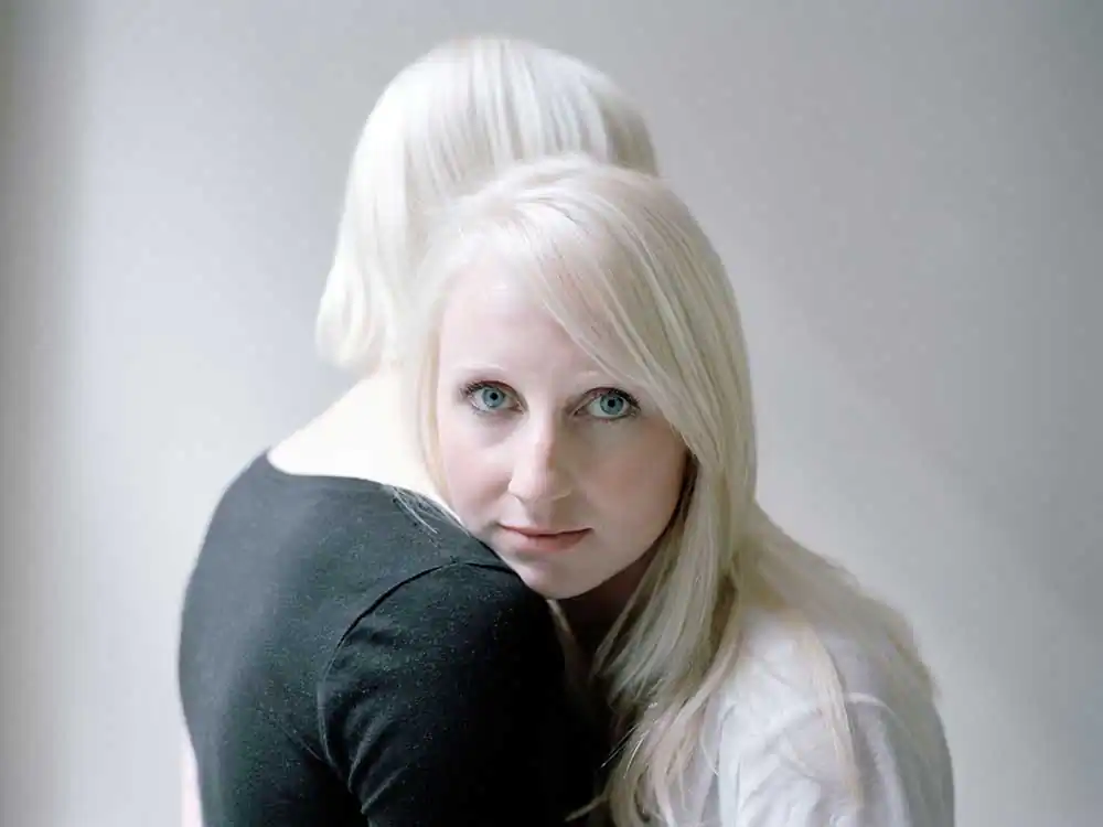 Al-bi-no by Kees Muizelaar