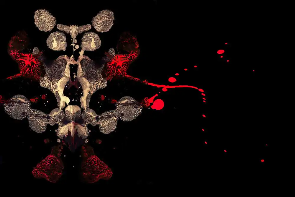 Painting & photography; Premature by Giovanni De Benedetto