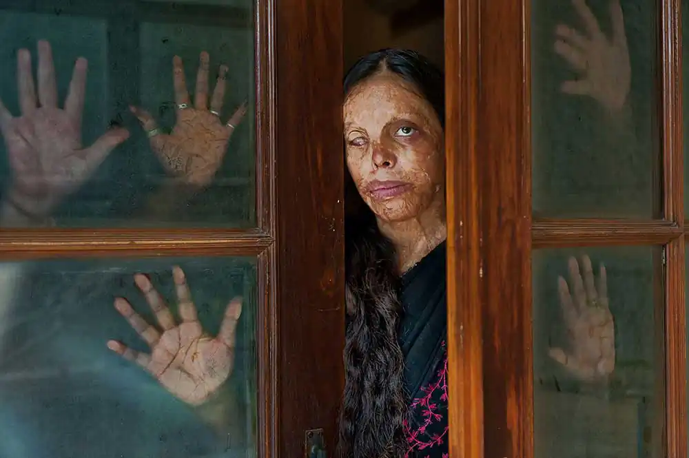 Survivors; Skin Project by Silvia Alessi